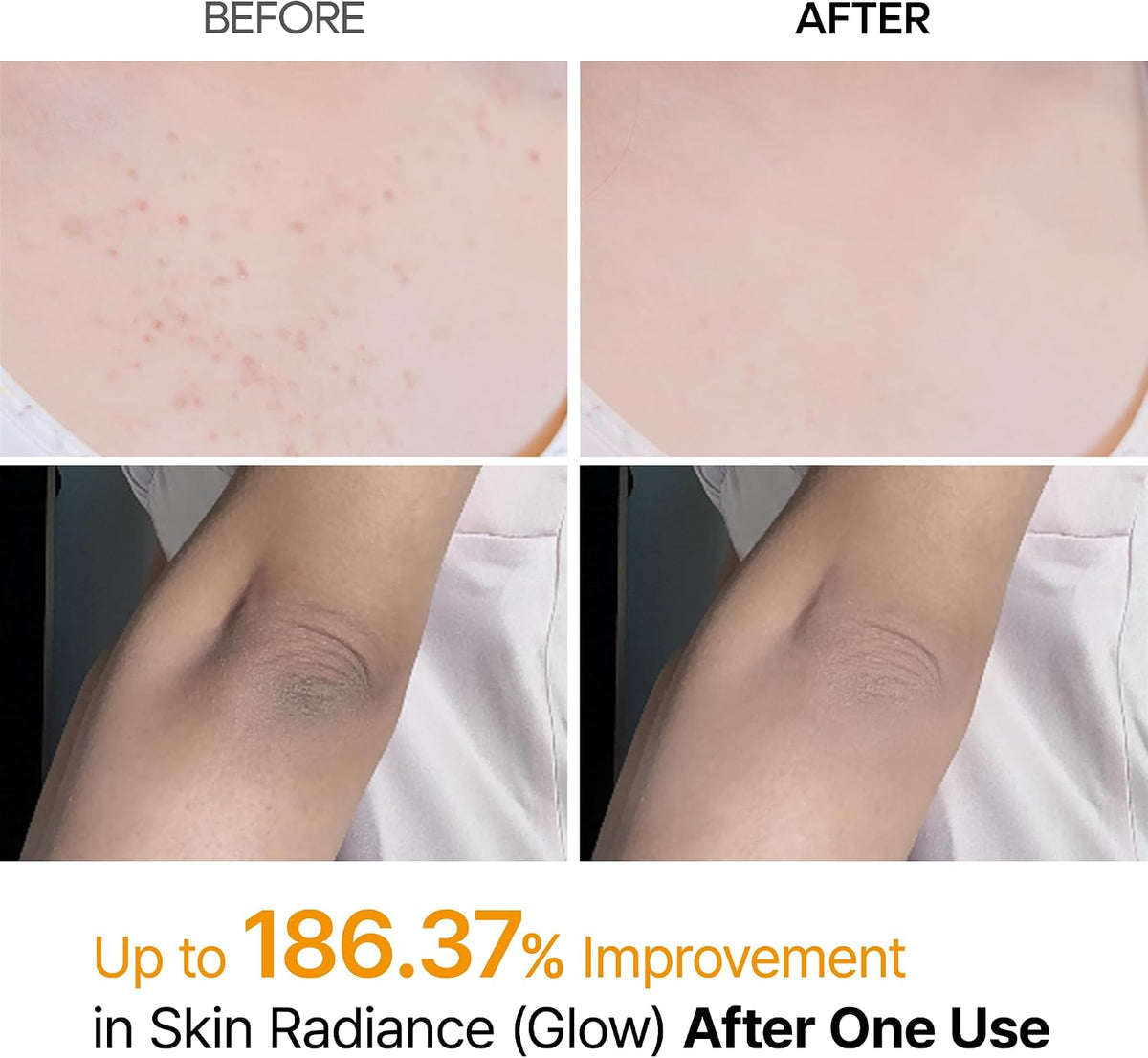 Dr.Melaxin Peel Shot Exfoliating Spray with Kojic Acid & Turmeric