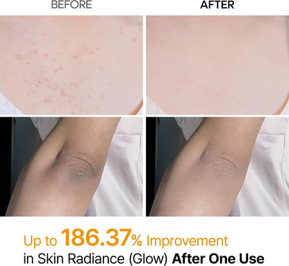 Dr.Melaxin Peel Shot Exfoliating Spray with Kojic Acid & Turmeric